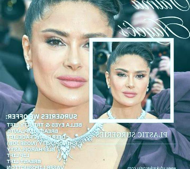 Abril 3 Narros escort