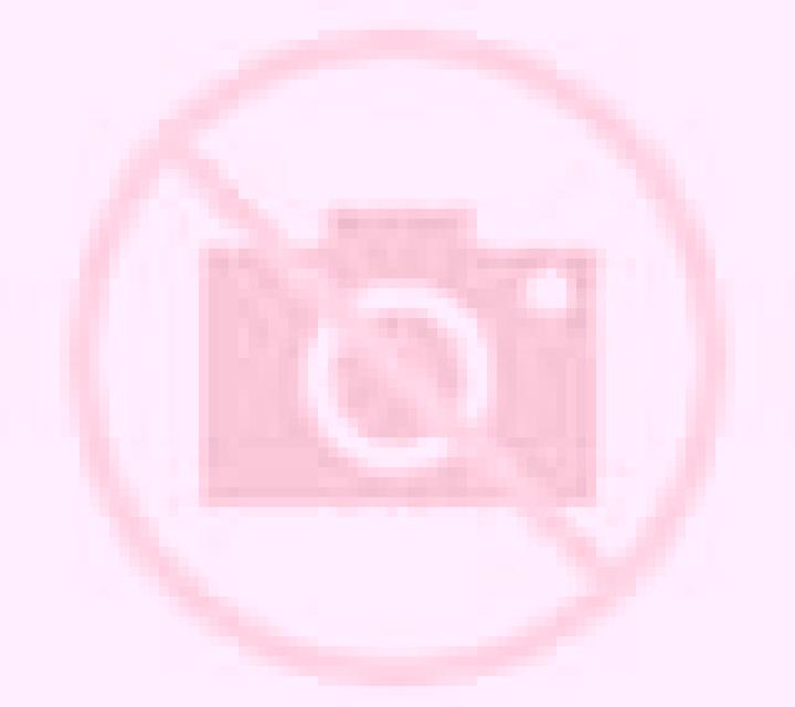Noa 3 Loeches escort